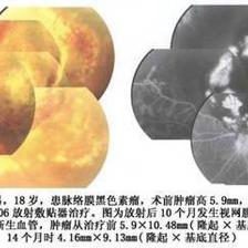 醫療利器 認識與使用敷貼器